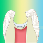 کلسیم هیدروکساید