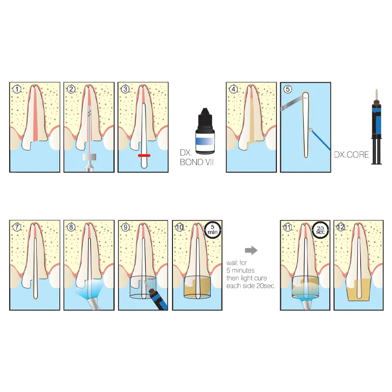 کامپوزیت کور بیلد آپ دوال کیور دنتکس DENTEX - Image 4